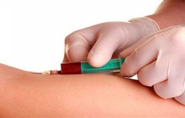 Αμφιβολίες κατά πόσο χρειάζεται πράγματι να μένει κανείς νηστικός πριν την εξέταση αίματος για χοληστερίνη 