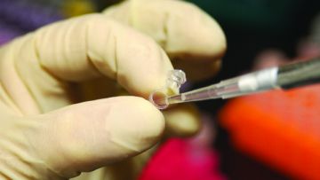 Τα... τεστ DNA πότε ξεκινούν στην Περιφέρεια;