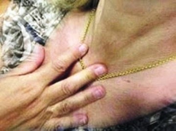 Ρόδος: Τσιγγάνοι άρπαξαν χρυσή αλυσίδα από τον λαιμό γυναίκας