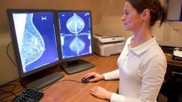 Το ABP 980: Αποτελεσματικό και ασφαλές βιοομοειδές  φάρμακο για τον καρκίνο μαστού