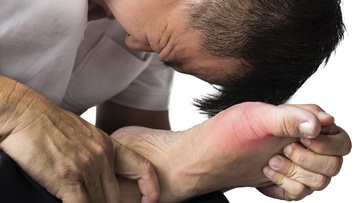 Ουρικό οξύ: Συμπτώματα, αντιμετώπιση και φυσιολογικά επίπεδα 