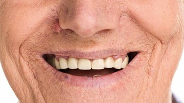 Προσοχή στη στοματική υγεία  των ηλικιωμένων