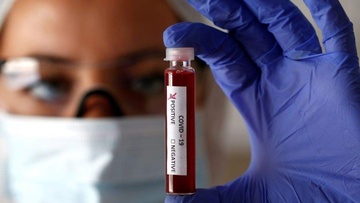 Κλειστές οι Διοικητικές και Οικονομικές Υπηρεσίες του Δήμου Κω σήμερα και αύριο εξαιτίας κρούσματος covid