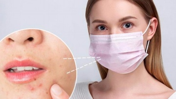 Πώς θα αποφύγουμε τις δερματικές  παθήσεις που προκαλεί η μάσκα