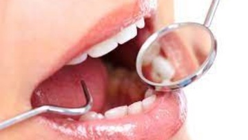 Ασθένειες στόματος και δοντιών: Ευνοούν εγκεφαλικά επεισόδια