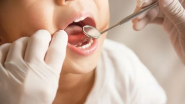 Dentist Pass: Παράταση  της προθεσμίας για αιτήσεις