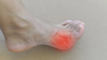 Ουρική αρθρίτιδα: Πόσο αυξάνει τον κίνδυνο χρόνιας νεφρικής νόσου