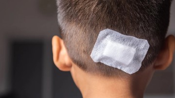 Αγγειοσάρκωμα: Ποια όργανα επηρεάζει -Τι συμπτώματα παρουσιάζει